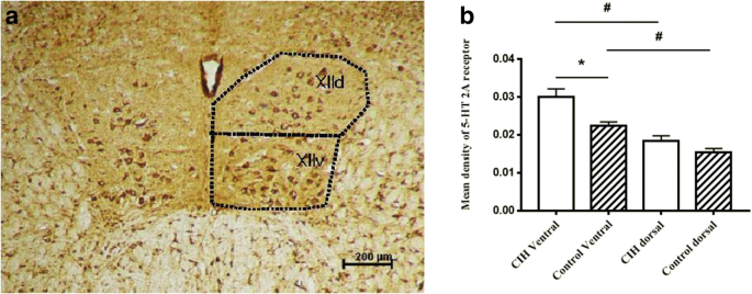 The dorsal and the ventral side of hypoglossal motor nucleus showed  different response to chronic intermittent hypoxia in rats | SpringerLink