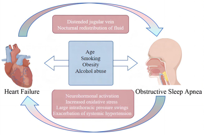 Up-to-date advance in the relationship between obstructive sleep apnea ...