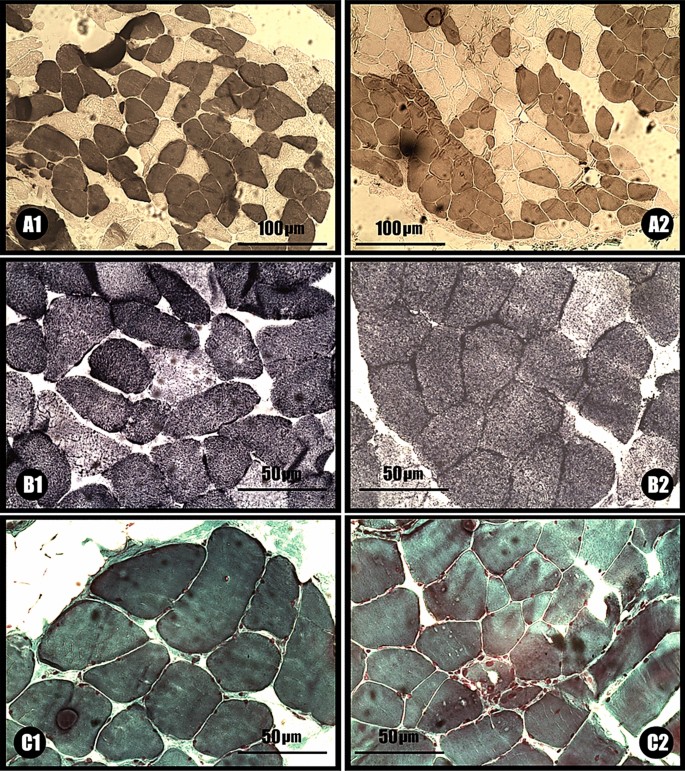 Force–time curve analysis and muscle histology in women aged 50–80 ...