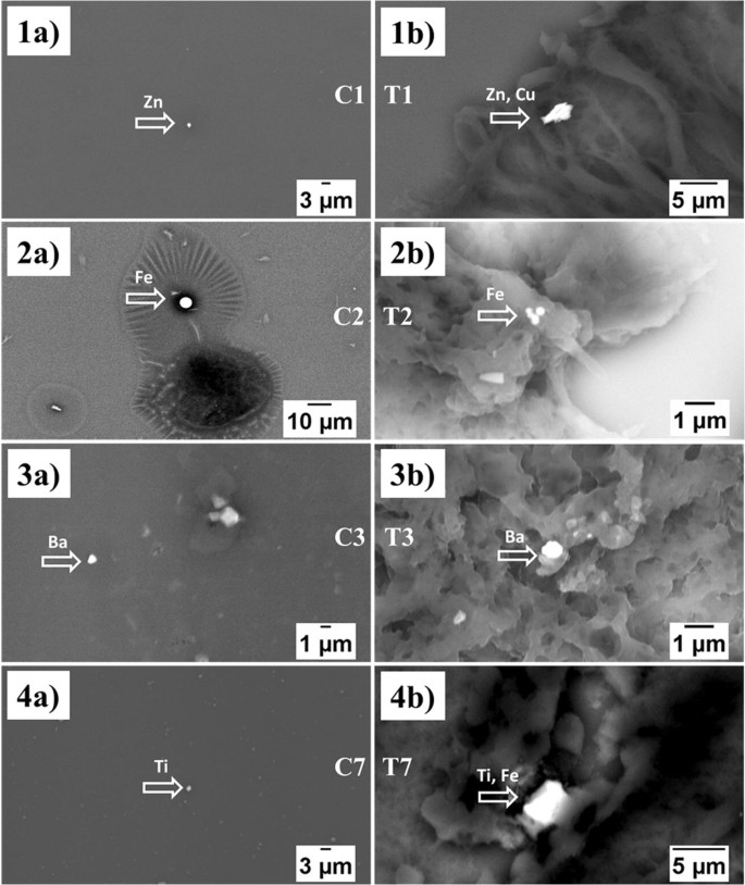 Metal Particles In Mucus And Hypertrophic Tissue Of The Inferior Nasal Turbinates From The Human Upper Respiratory Tract Springerlink