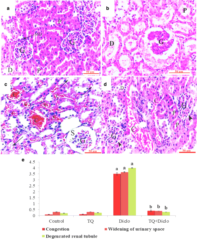 Thymoquinone alleviates mitochondrial viability and apoptosis in diclofenac-induced  acute kidney injury (AKI) via regulating Mfn2 and miR-34a mRNA expressions  | SpringerLink