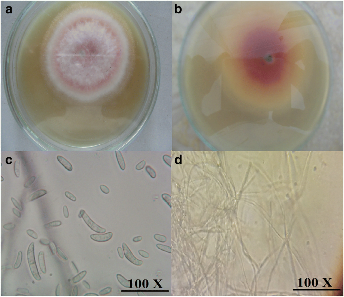 The Potential Impact Of Octopus Cyanea Extracts To Improve Eggplant Resistance Against Fusarium Wilt Disease In Vivo And In Vitro Studies Springerlink