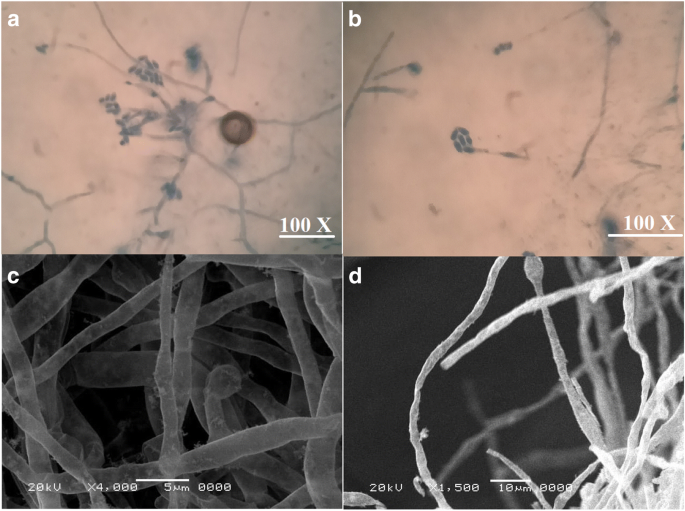 The Potential Impact Of Octopus Cyanea Extracts To Improve Eggplant Resistance Against Fusarium Wilt Disease In Vivo And In Vitro Studies Springerlink
