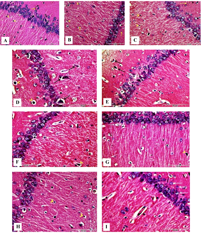 Anti-kindling effect of Ginkgo biloba leaf extract and L-carnitine in the pentylenetetrazol model of epilepsy | Environmental Science and Pollution Research | Springer Nature Link Anti-kindling effect of Ginkgo biloba leaf extract and L-carnitine in the pentylenetetrazol model of epilepsy | Environmental Science and Pollution Research | Springer Nature Link