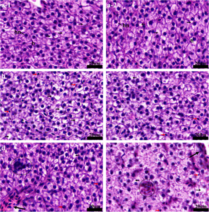 Impact on the antioxidant system, histology, and cell death of