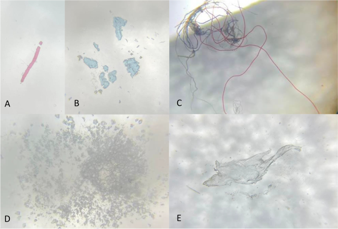 Microplastics in surface water of Laguna de Bay: first documented evidence  on the largest lake in the Philippines | Environmental Science and  Pollution Research