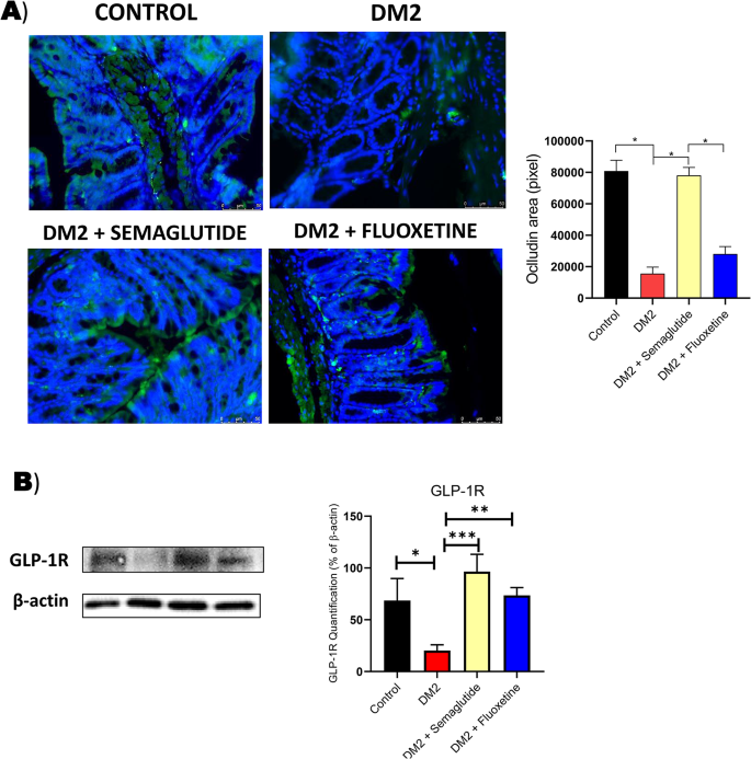 does semaglutide affect serotonin Semaglutide Attenuates Anxious and Depressive-Like Behaviors and Reverses  the Cognitive Impairment in a Type 2 Diabetes Mellitus Mouse Model Via the  Microbiota-Gut-Brain Axis | Journal of Neuroimmune Pharmacology