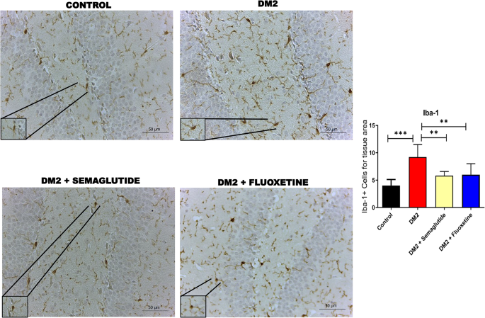 fluoxetine and semaglutide Semaglutide Attenuates Anxious and Depressive-Like Behaviors and Reverses  the Cognitive Impairment in a Type 2 Diabetes Mellitus Mouse Model Via the  Microbiota-Gut-Brain Axis | Journal of Neuroimmune Pharmacology