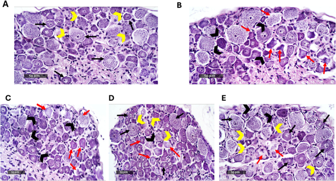 semaglutide fibromyalgia Novel Trajectories Towards Possible Effects of Semaglutide for Amelioration  of Reserpine-induced Fibromyalgia in Rats: Contribution of cAMP/PKA/p-CREB  and M1/M2 Microglia Polarization | Journal of Neuroimmune Pharmacology