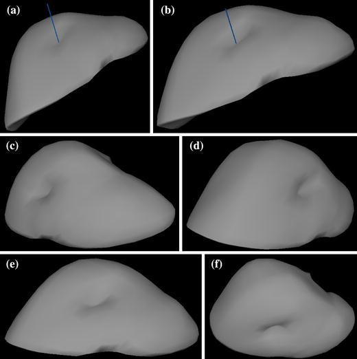 figure 15