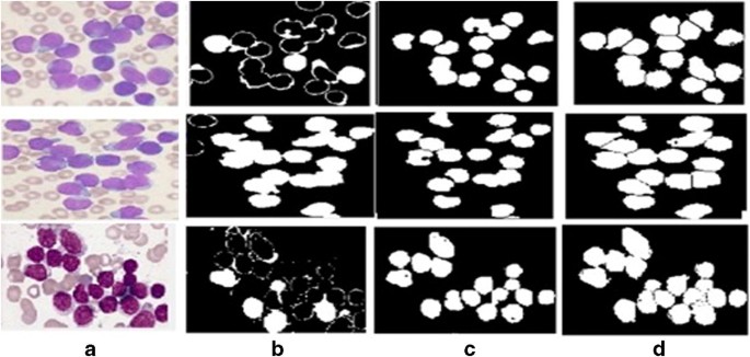 figure 18