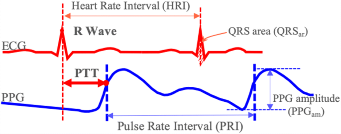 Pulse respiratory rate estimation with singular spectrum analysis | SpringerLink