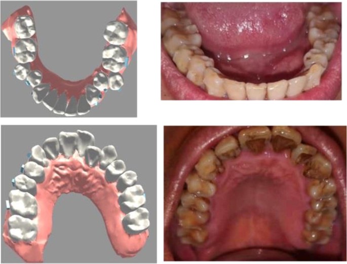 figure 15