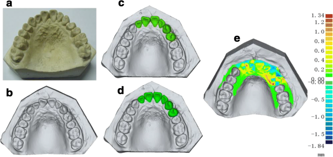 figure 16