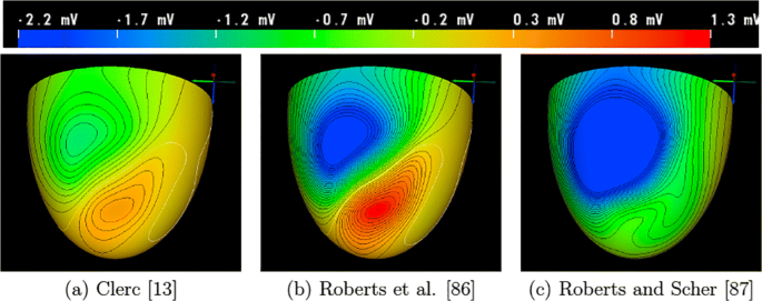 Approaches For Determining Cardiac Bidomain Conductivity Values Progress And Challenges Springerlink Approaches For Determining Cardiac Bidomain Conductivity Values Progress And Challenges Springerlink