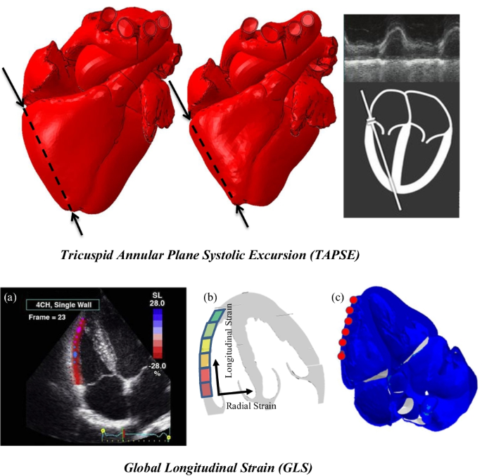 Validation of the Tricuspid Annular Plane Systolic Excursion