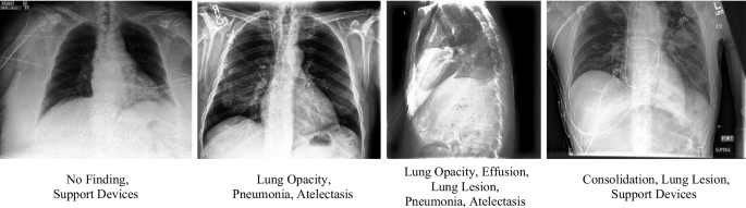 Label the structures in the chest x-ray using the hints provided.