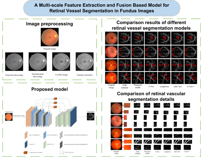 A multi-scale feature extraction and fusion-based model for retinal ...