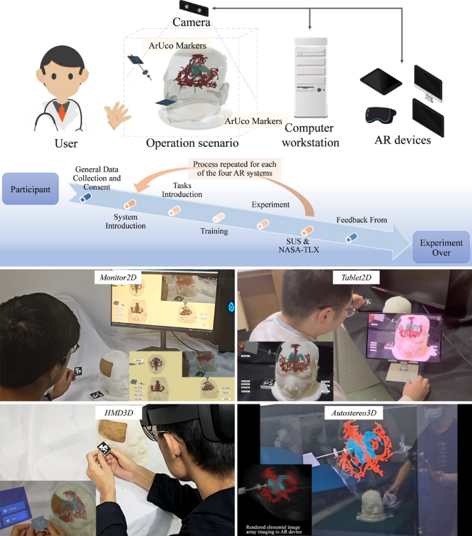 Comparison of augmented reality visualization approaches in minimally ...