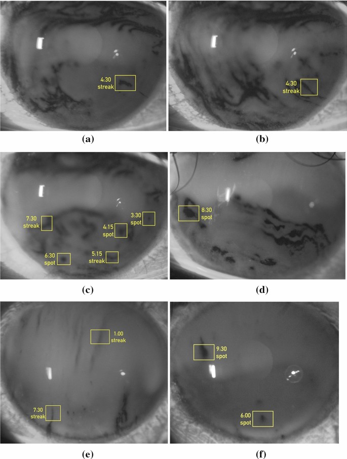 figure 18