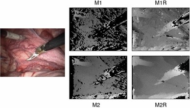 figure 11