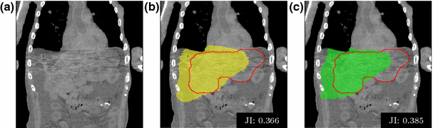 figure 21