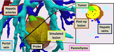 figure 17