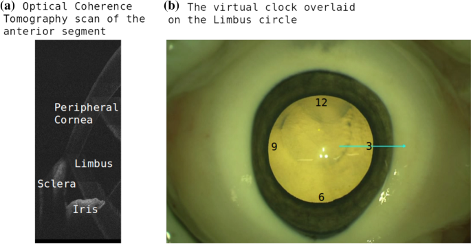Automatic intraoperative optical coherence tomography positioning ...