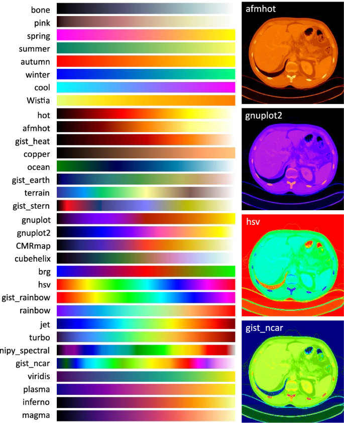 Colormap augmentation: a novel method for cross-modality domain ...