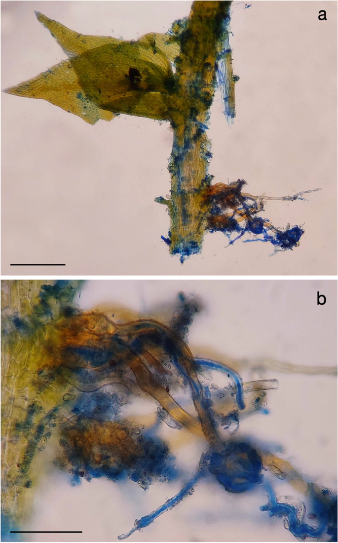 Octospora tucumanensis (Pezizales), a new bryophilous ascomycete on  Dimerodontium balansae (Bryophyta) from Argentina