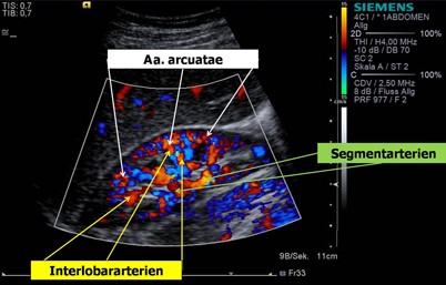 Ultraschall der Niere und ableitenden Harnwege | SpringerLink