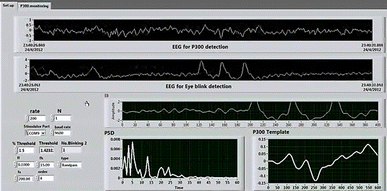 figure 21