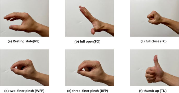 Electromyographic evaluation of upper limb muscles involved in armwrestling  sport simulation during dynamic and static conditions - ScienceDirect