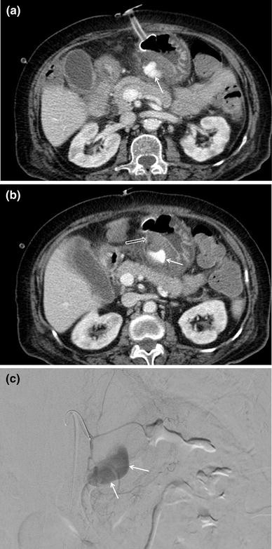 figure 22