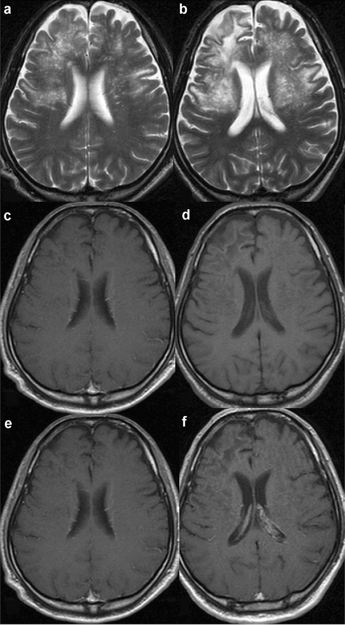 2 Brain | Radiology Key