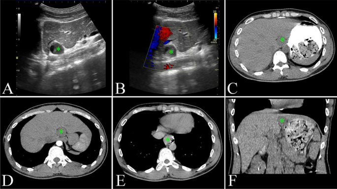 figure 20