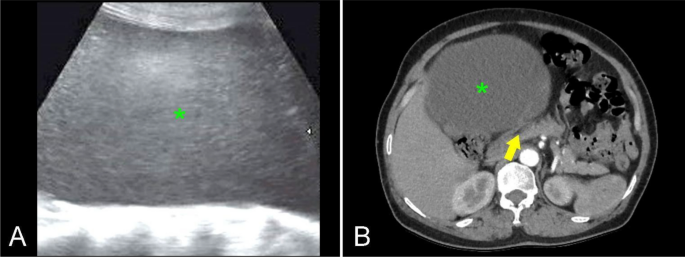 figure 21