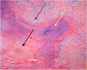 Ne perdez pas de temps ! 5 faits pour commencer http://onlinetri.com/livres/incs/dosages-et-m-thodes-d-utilisation-de-turinabol.html Top 10 des tactiques clés que les pros utilisent pour http://onlinetri.com/livres/incs/dosages-et-m-thodes-d-utilisation-de-turinabol.html