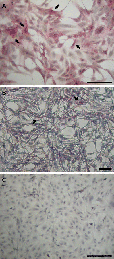 Examination of ZEB2J cultures for ES cell characteristics. (A) Cells at