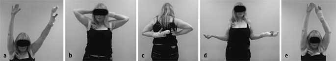Das chronisch instabile Schultergelenk nach operativer Rekonstruktion |  SpringerLink