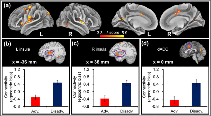 The Neural Signatures Of Egocentric Bias In Normative Decision Making Springerlink