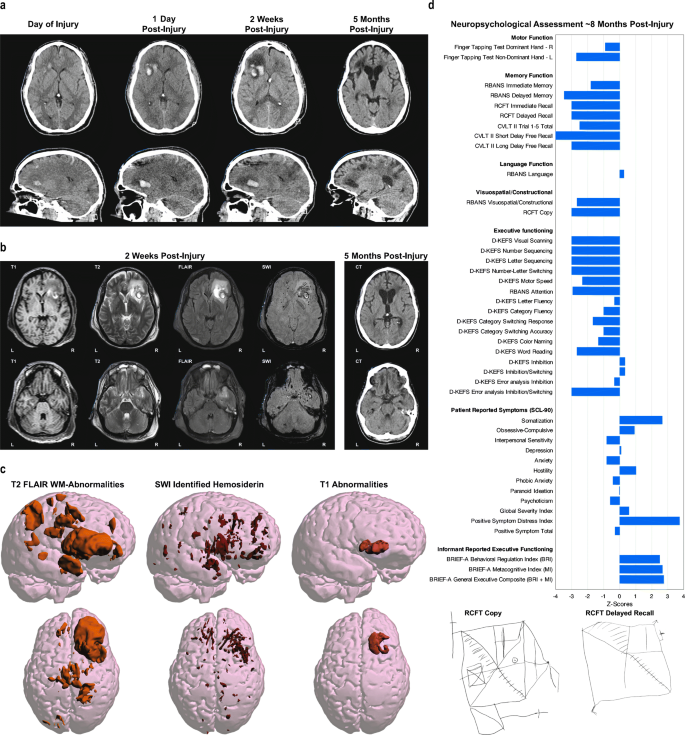 Long-term Multidomain Patterns of Change After Traumatic Brain Injury