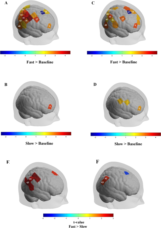 Differences in brain activity between fast and slow responses on  psychomotor vigilance task: an fNIRS study | SpringerLink