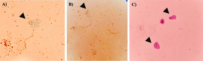 New Commercially Available PCR Test Detects 3 Brain-Eating Amoebas in 3  Hours