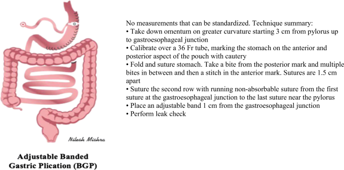 figure 23