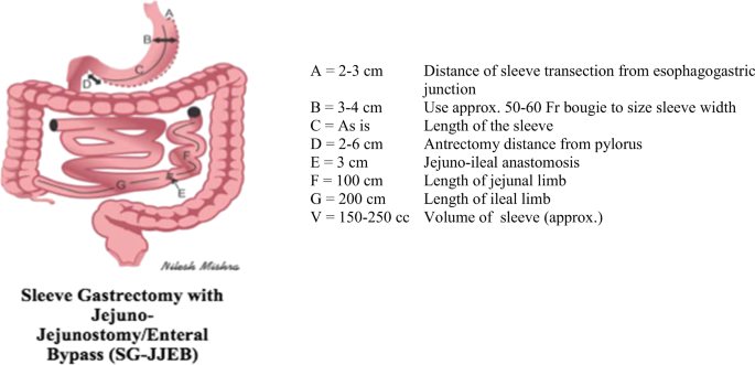 Standardization Of Bariatric Metabolic Procedures World Consensus Meeting Statement Springerlink