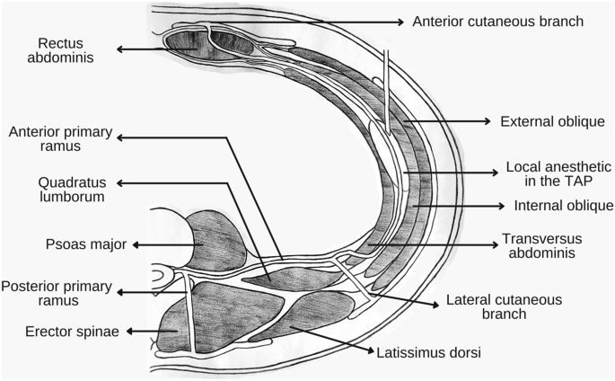 Anatomical variations of the thoracolumbar nerves with reference to  transverse abdominal plane (TAP) block