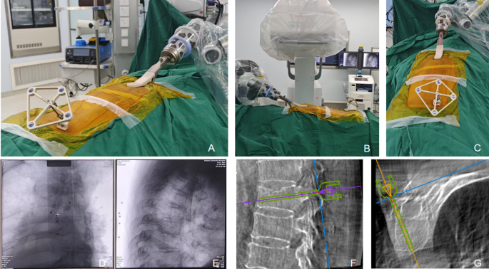 Evaluation of clinical application and effectiveness of robot-assisted ...
