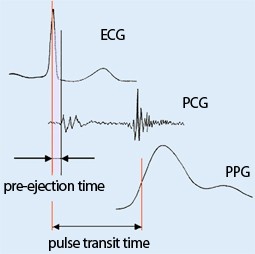 Continuous blood pressure measurement using pulse |