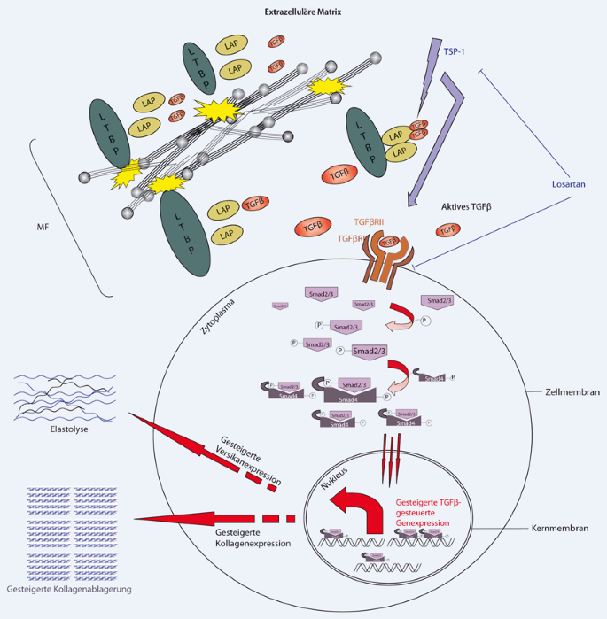 Fortschritt In Der Pathogenese Des Marfan Syndroms Und Verwandter Krankheiten Springerlink